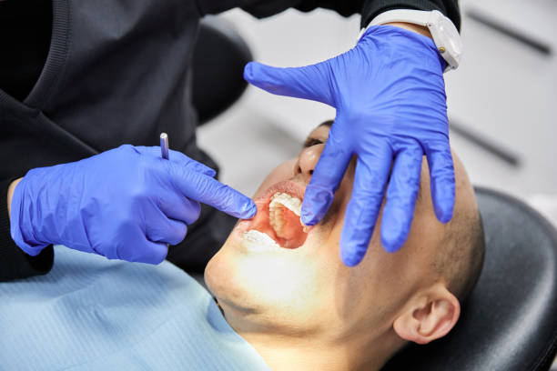 Best Emergency Wisdom Teeth Removal in Pigeon Forge, TN